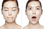 宽脸腮怎么变瘦,腮宽怎么解决
