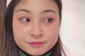 脸两侧颧骨太宽怎么办,额头两边太宽怎么办图片
