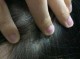 男生头皮屑多是什么原因（男生头皮屑多是什么原因引起的）