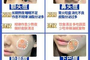 怎么样快速消除痘痘（怎么样快速消除痘痘红肿）