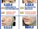 怎么样快速消除痘痘（怎么样快速消除痘痘红肿）