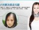怎么样能防止脱发（怎么样能防止脱发,使头发增多）