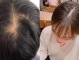 头皮是什么颜色（头皮是什么颜色为正常）