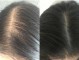 头发越来越少是怎么回事（头发越来越少是怎么回事女性）