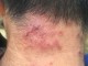 头痒有什么小窍门（头很痒是怎么回事）