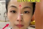 如何瘦脸,什么样能瘦脸最快