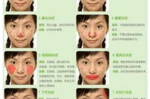 脸上冒痘痘怎么快速消除,怎么样去痘痘好得快