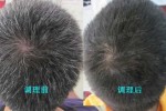 前额有很多白发这个症状该怎么调理呢,头顶白发吃什么药能变黑