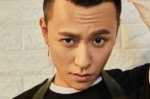 两侧发际线较高剪什么头型,两侧发际线高什么发型好看