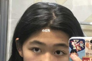 脑门低怎么办（发际线低怎么办）