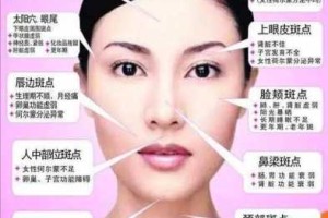 脸上长斑了该怎么办,面部长斑怎么办分析图