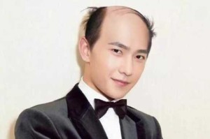 地中海头型一般都是什么人,地中海应该剪什么发型好看