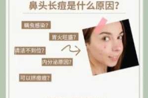 鼻子起痘痘怎么办（鼻子起痘痘怎么办?）