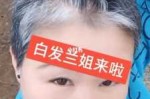 年纪很小出现了很多白头发，怎么办好,有很多白发怎么办女生