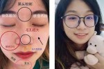 皮肤毛孔大有黑头怎么办（脸上毛孔粗大还有黑头爱出油怎么办）