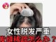 脱发严重怎么治疗,脱发非常严重怎么办女性