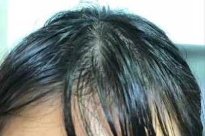 为什么头发特别容易油（为什么头发特别容易油还痒）