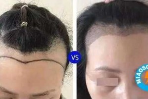 什么叫种头发（什么叫种头发的女人）