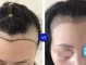 什么叫种头发（什么叫种头发的女人）