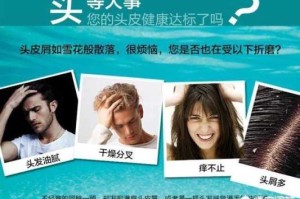 有什么方法可以去头皮屑（头屑多怎么去除小妙招）