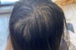 发量少怎么办（发量少怎么办如何增加发量）