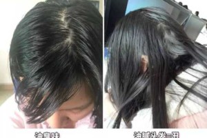 为什么染了头发容易头油,头发易油是什么原因造成的