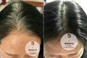 白发怎么看（怎么分辨能洗掉白发的是正品）