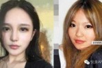 瓜子脸怎么整（天生瓜子脸的人多吗）