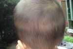 头发不黑是什么原因（宝宝头发不黑是什么原因）