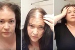 女性头发少怎么办（女性头发少怎么办）
