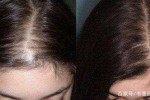 头顶头发越来越少怎么办（头顶头发越来越少怎么办女性）