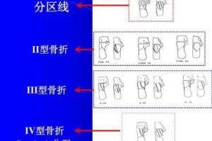 骨什么型（骨型什么意思）