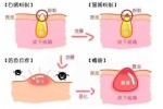 白头怎么除（白头咋去除）
