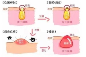 白头怎么除（白头咋去除）
