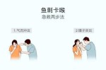 鱼刺扎手里咋办,扎了鱼刺怎么办嗓子