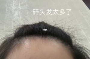 碎头发多是什么原因（碎头发太多怎么办）