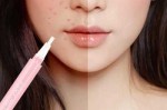用什么化妆品可以遮住脸上的斑（用什么化妆品可以遮住脸上的斑点）