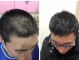 男生头发稀少怎么变浓密（15岁男生头发稀少怎么变浓密）