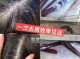 头发痒有头皮屑怎么办（头发痒有头皮屑怎么办小窍门）