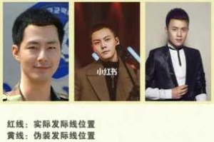 左右两边发际线太高了怎么挽救,男生额头两边发际线高怎么办