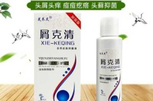干性头皮屑用什么洗发水去屑止痒,干性头皮屑多是什么原因引起的