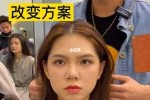 菱形脸怎么矫正,菱形脸怎么改变脸型不用手术