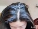 掉头发严重怎么办？怎么治疗掉头发,头发掉的严重怎么办女