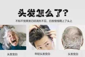 为什么头发硬（为什么头发硬的人会容易生白发）