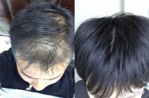头发为什么长的慢（为什么头发很疏，长得很慢）