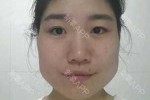 倒瓜子脸长什么样子（倒过来的瓜子脸是什么样子的）