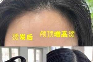 头发贴头皮是什么原因（头发太贴了怎么办）