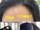 头发贴头皮是什么原因（头发太贴了怎么办）