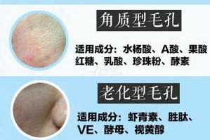 毛孔怎么看（毛孔怎么看出来）