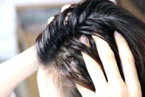 为什么后脑勺头发突然变得容易油,为什么头会出油有异味怎么办